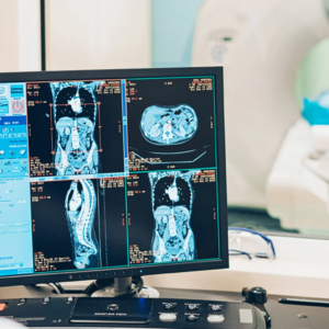 GlycoCheck(Vascular)